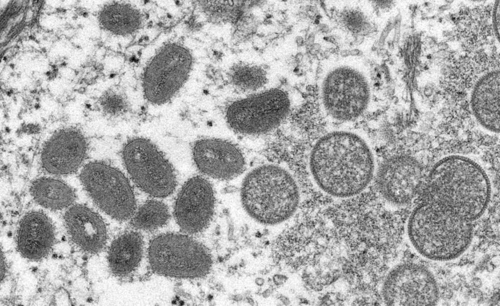 The WHO has said it will change monkeypox's name after scientists said it was "not only inaccurate but is also discriminatory and stigmatising" The WHO has said it will change monkeypox's name after scientists said it was "not only inaccurate but is also discriminatory and stigmatising"