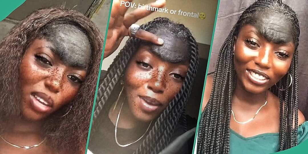 Watch trending video of Nigerian lady with unique birthmark