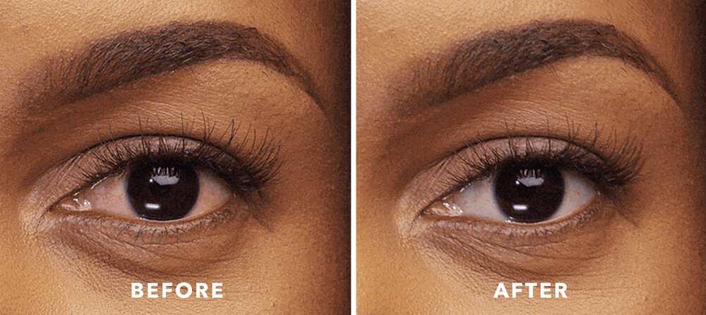How To Make Your Eyes White Legit Ng - Diy Eye Lightening Drops