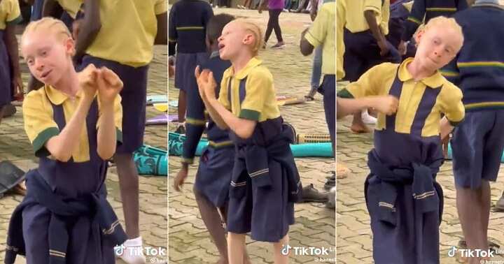 Albino girl dances at school party