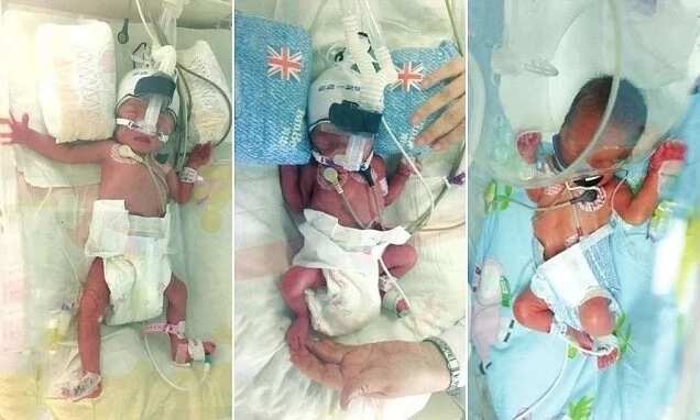Woman who was barren gives birth TWICE in ONE WEEK, and they are triplets (photos)