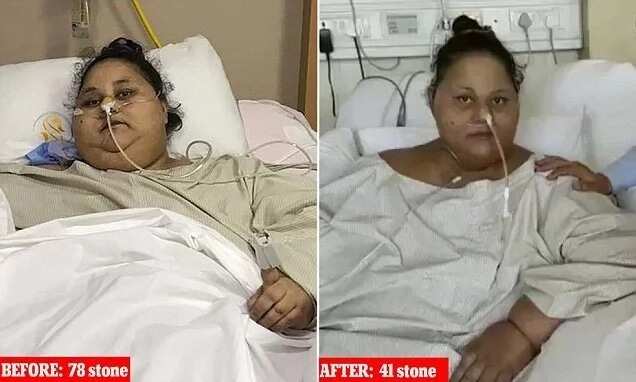 World's heaviest woman sits up for 1st time after losing half her weight