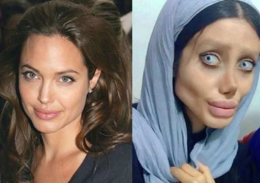 Plastic surgery gone wrong! Woman, 19, underwent 50 surgeries to look like Angelina Jolie