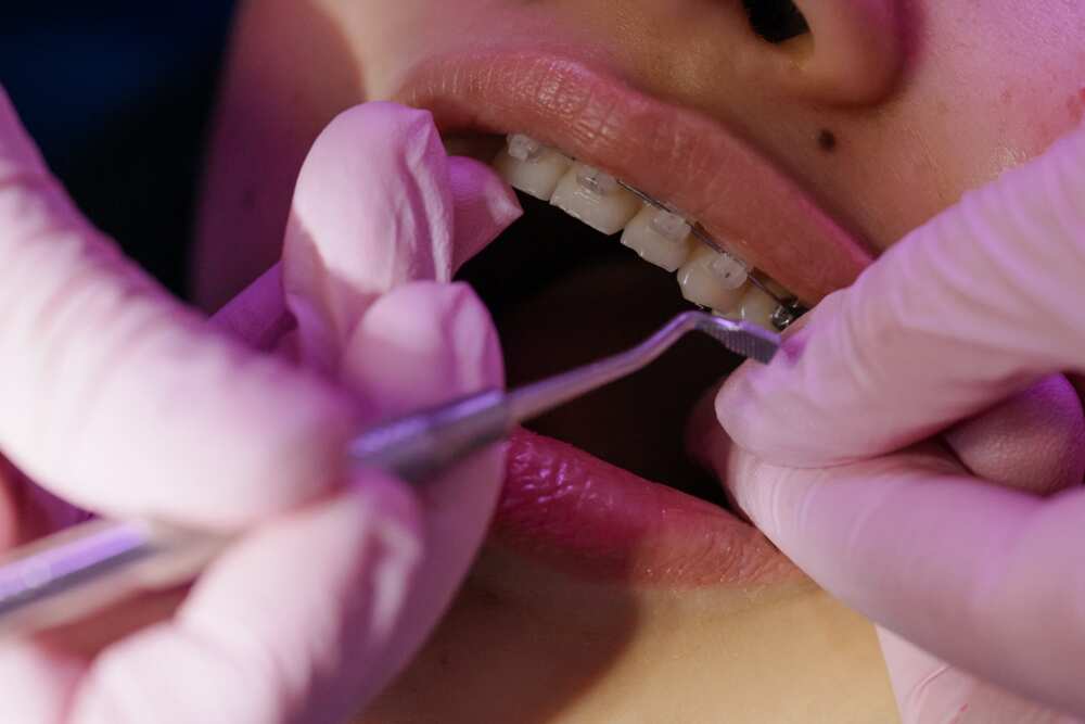 Treating of a tooth with braces