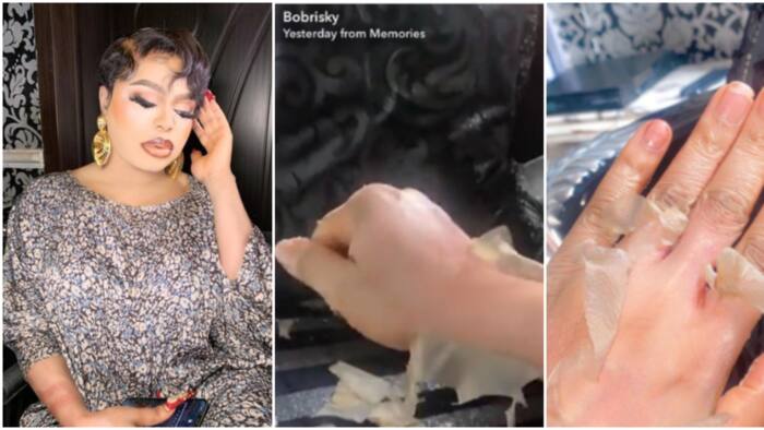 “When you no be snake”: Bobrisky causes massive stir online after sharing photos of his skin peeling