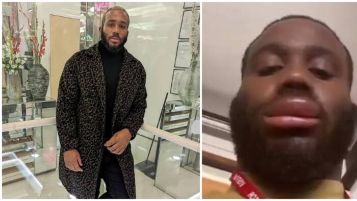 "Maybe e put mouth for wetin no concern am: Reactions to video of BBNaija Kiddwaya with swollen lips after being stung by bee