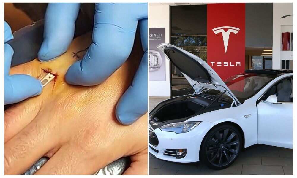 Tesla car, Chip Implant