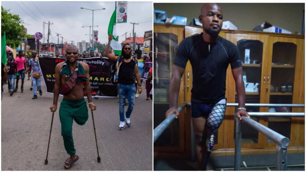 Man who joined protest with 1 leg, gets new prosthetic, money from Nigerians