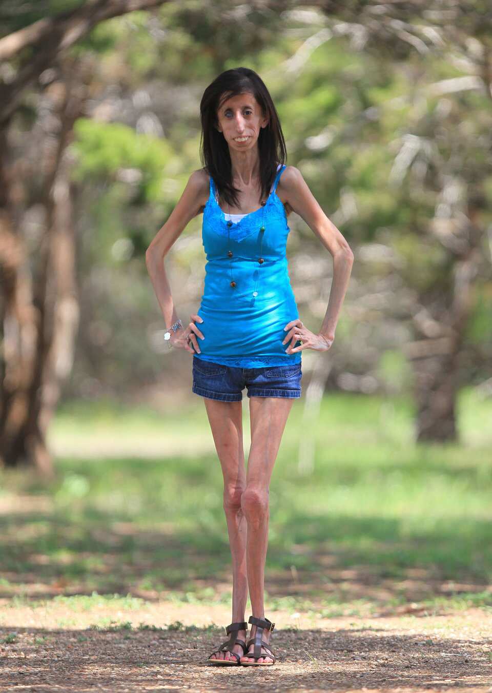 the skinniest person in the world guinness world record