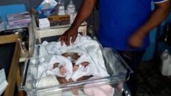 28-year old woman surprised after giving birth to Siamese twins