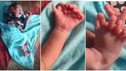 Indian baby born with 26 fingers & toes hailed as reincarnation of Hindu goddess, photos stun many