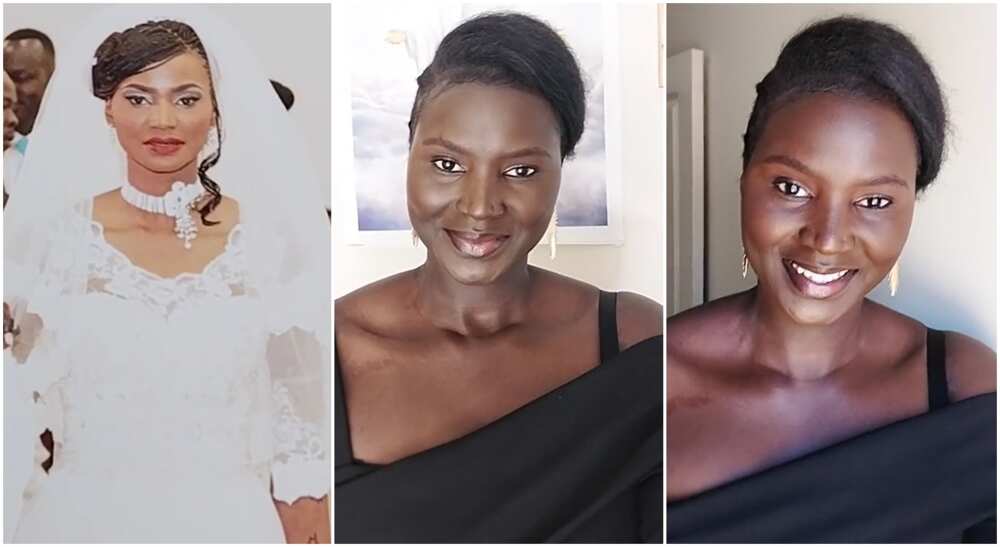 Photos of a lady who used to bleach her skin.