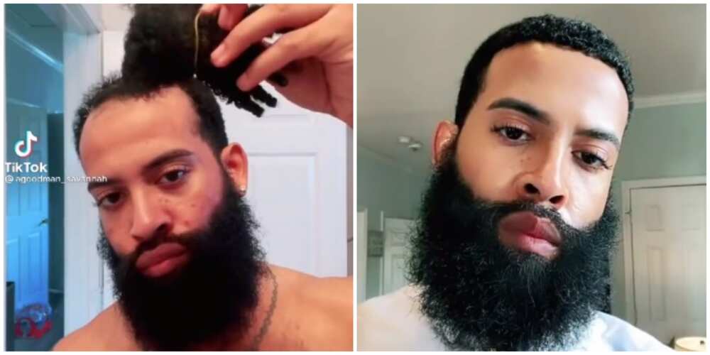 Man Shows How He Fixed Receding Hairline Using Women's Weave-on, Sparks  Reactions Online 