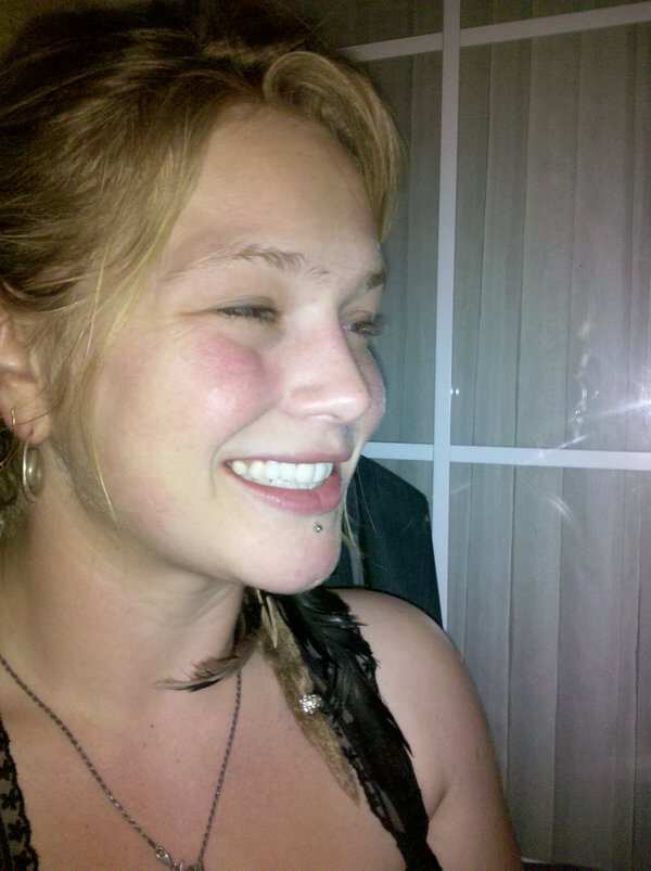 Crystal Bowersox teeth