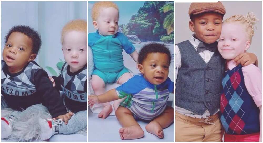 Photos of rare twins, one albino, one black.
