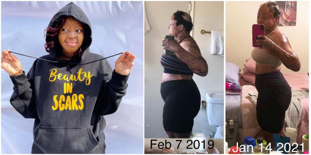 Plane crash survivor Kechi Okwuchi shares body transformation photos