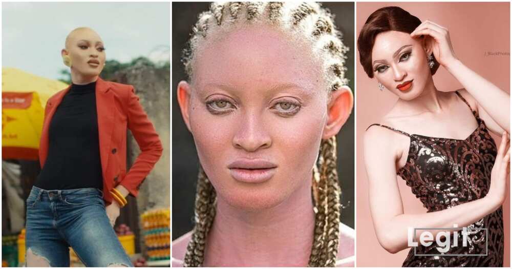 Vivian Adenijo, 24-year-old model, albino, Osun state, Nigeria, People Living with Albinism (PWA)