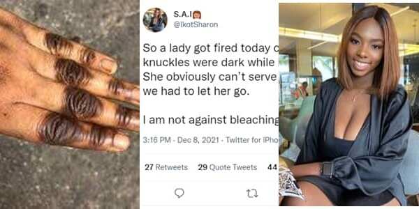 Nigerian Restaurant fires Waitress for Bleaching her Skin, Having Dark Knuckles