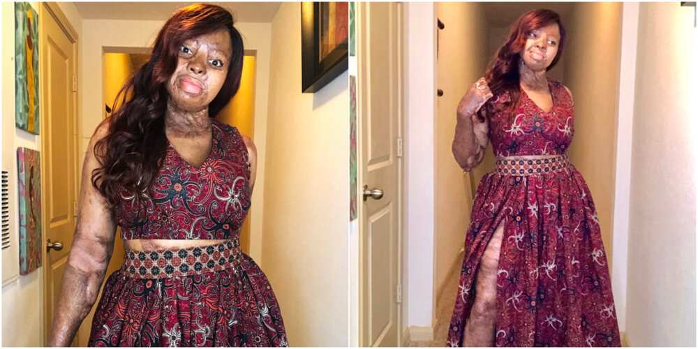 Plane crash survivor Kechi Okwuchi rocks lovely attire that gets social media talking