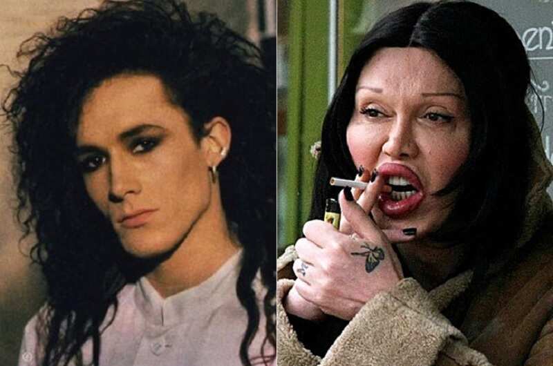 Pete Burns before and after