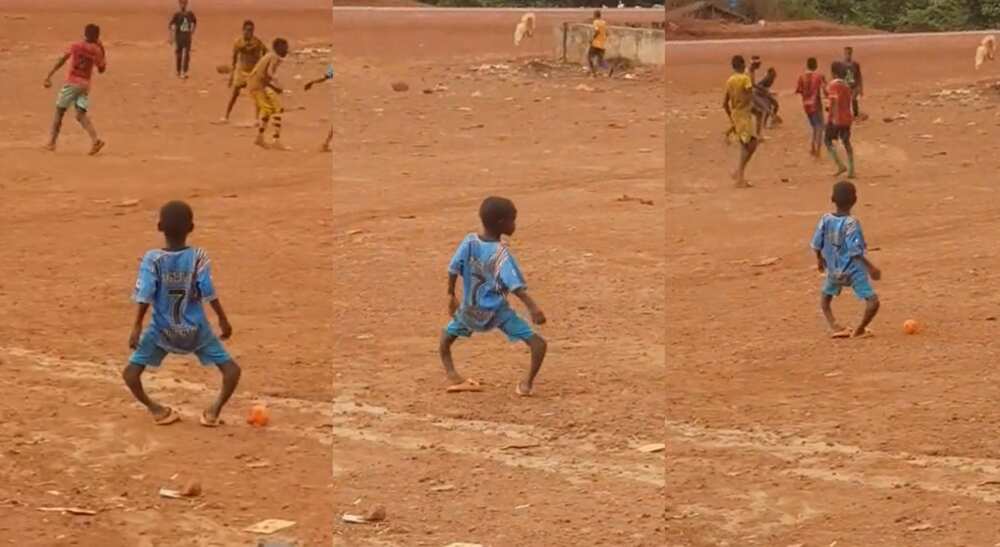 Photos of a boy with bowel legs.