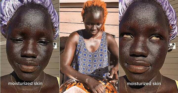 Lady with unique skin tone, melanin