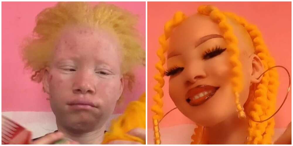 Photos of the albino fashionista