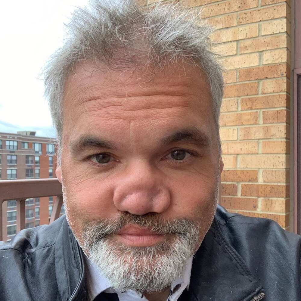 Artie Lange nose