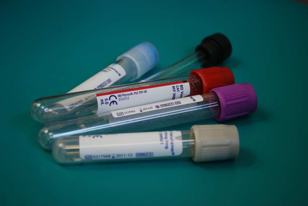 Coronavirus diagnosis Coronavirus diagnosis