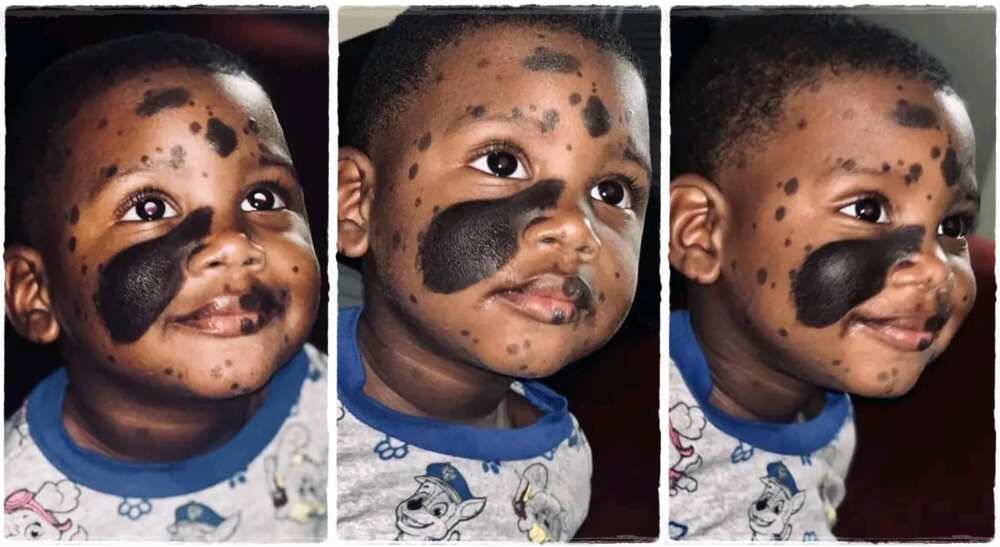 Photos of a boy with black patches on his face.