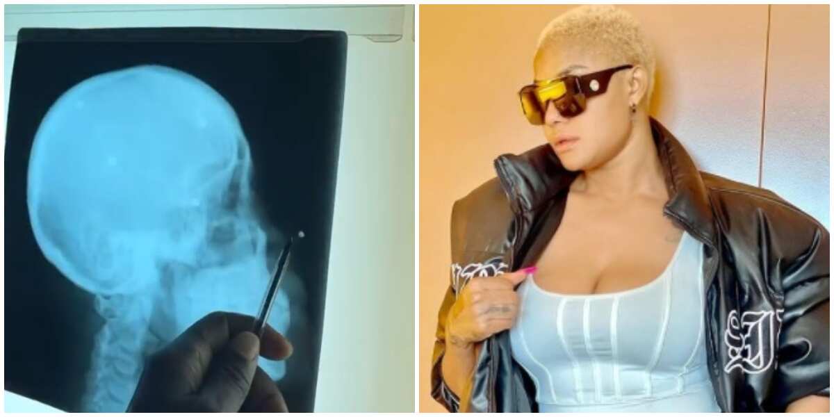 Angela Okorie says pellets still coming out of her head two years after failed assassination