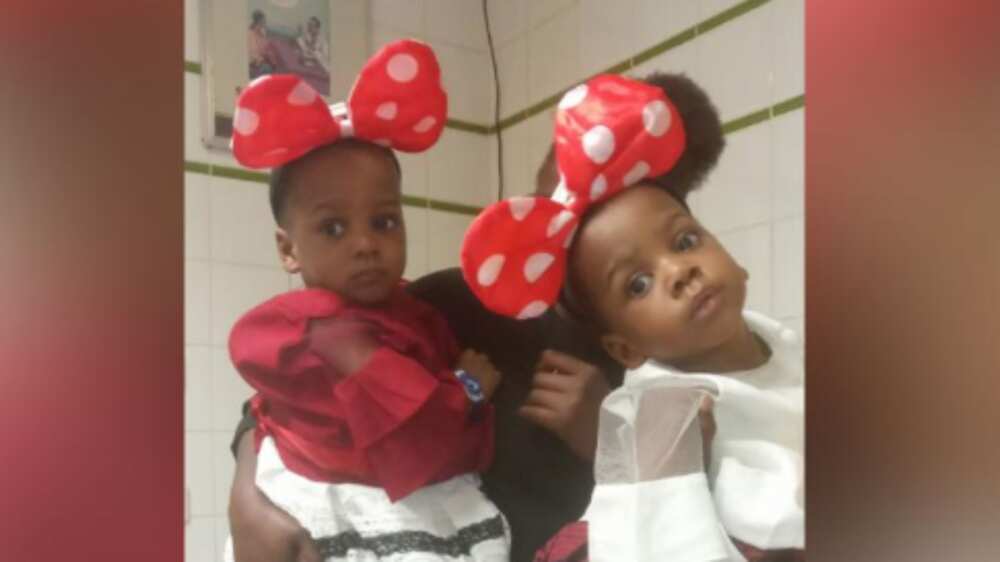 Nigerian doctors successfully separate conjoined twins in Abuja (photos)