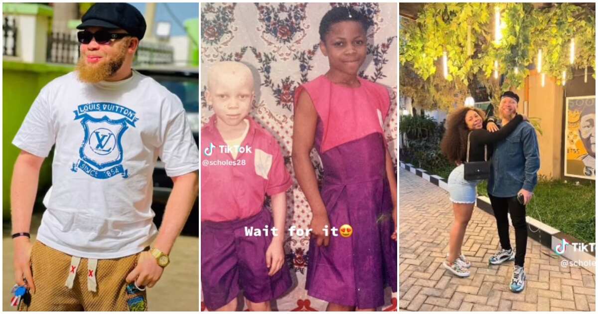 Transformation video of Nigerian albino boy to a handsome young man causes stir online