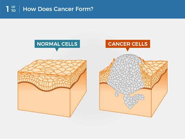 Laptop radiation does not cause skin cancer but it can contribute to male infertility