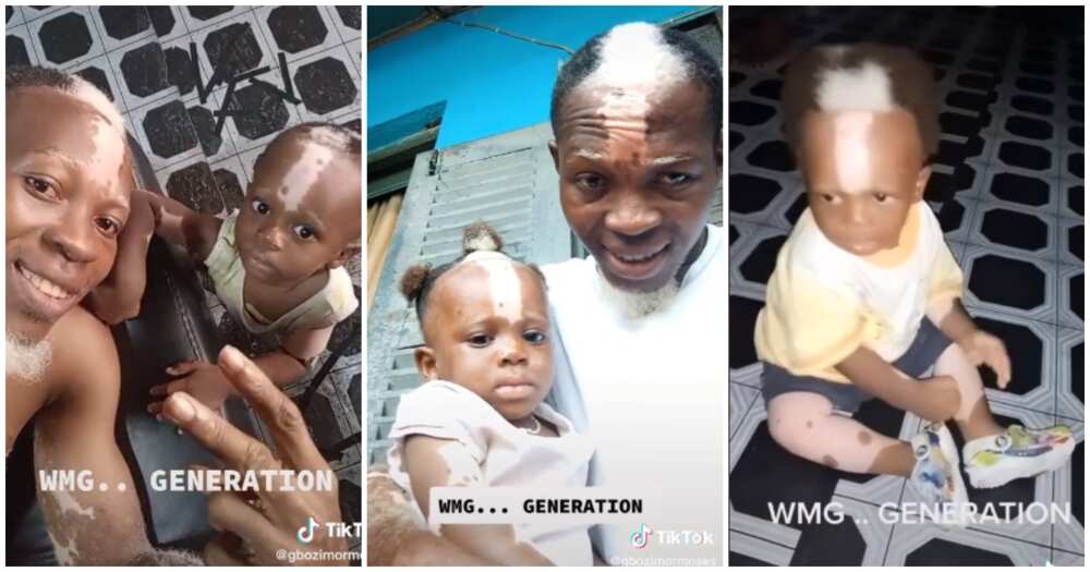 Nigerian kid born with white frontal hairs, kid and dad birn with white frontal hairs, video of Nigerina kid born with white frontal hairs and unique birth marks