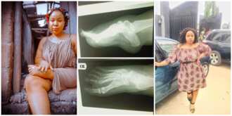 Lady Born with One and Half Leg Says she is Tired of Pains and Injuries, Begs Nigerians to Help Her Walk Again