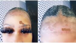 All the hair is in the lashes: Reactions as lady's edges chop off after using hair glue for weeks