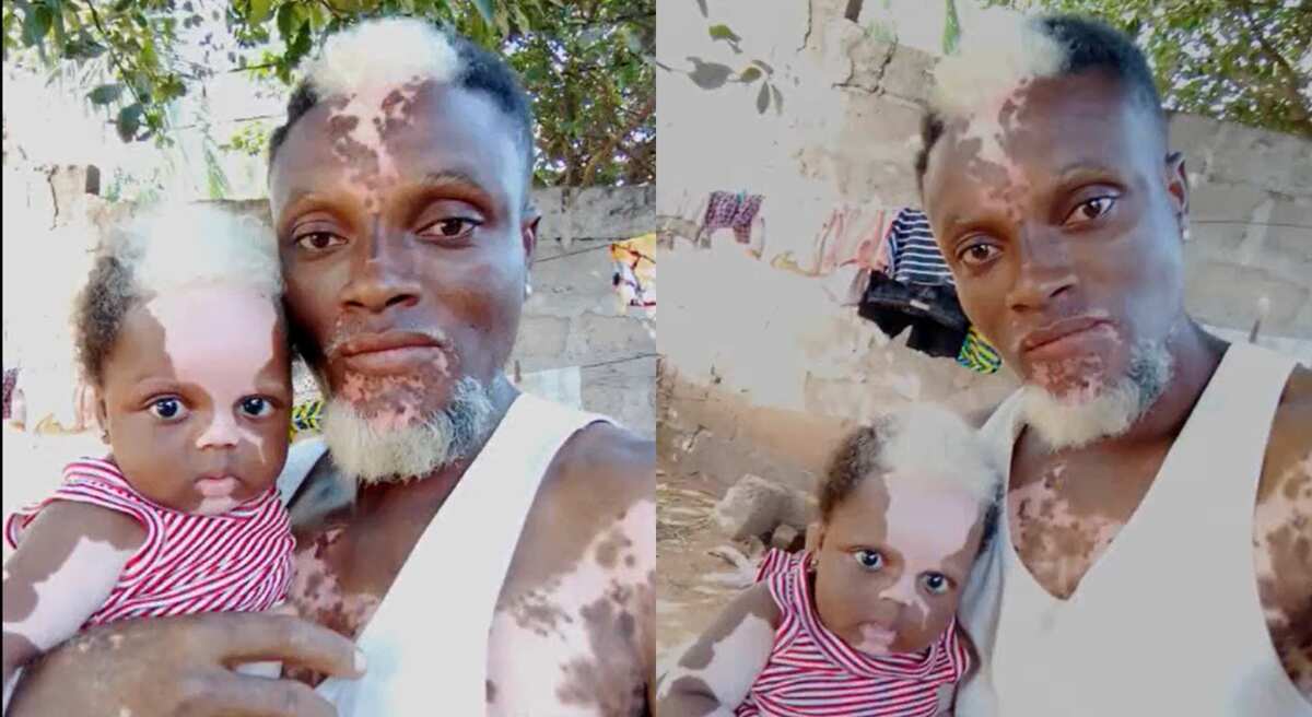 Video: This girl newborn baby looks like her father, see what is on her body