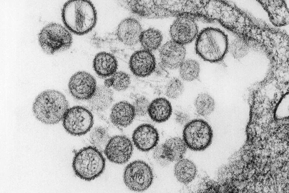 hantavirus hantavirus
