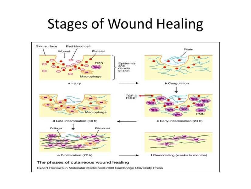 Infected Wound Healing Stages