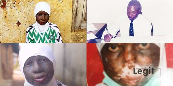 I cannot breathe - Rokeebat needs N2m to save her life from deadly nose infection