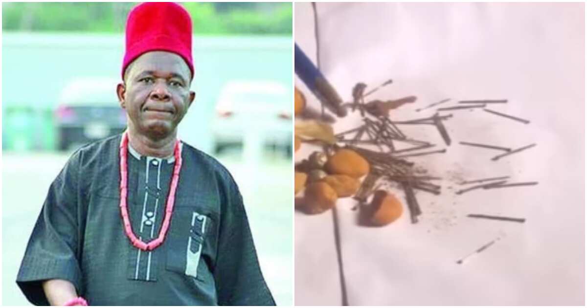 Chiwetalu Agu survives spiritual attack, claims arrows, other mysterious Items were brought out of his chest