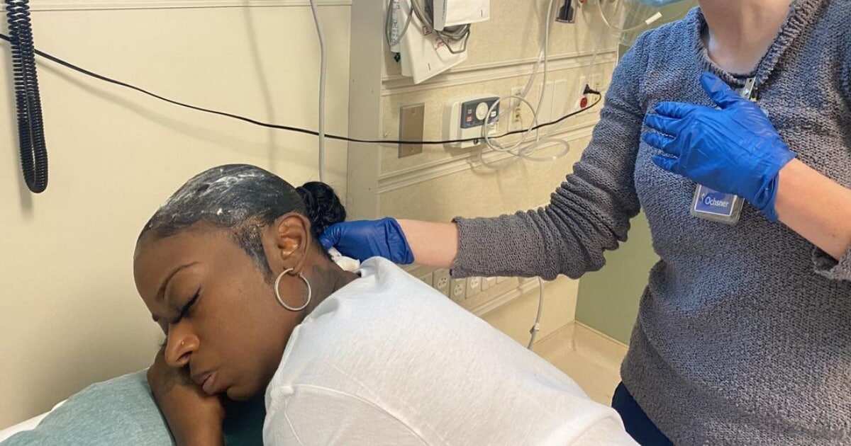 Massive reactions as woman is hospitalised after she used strong glue on her hair instead of gel