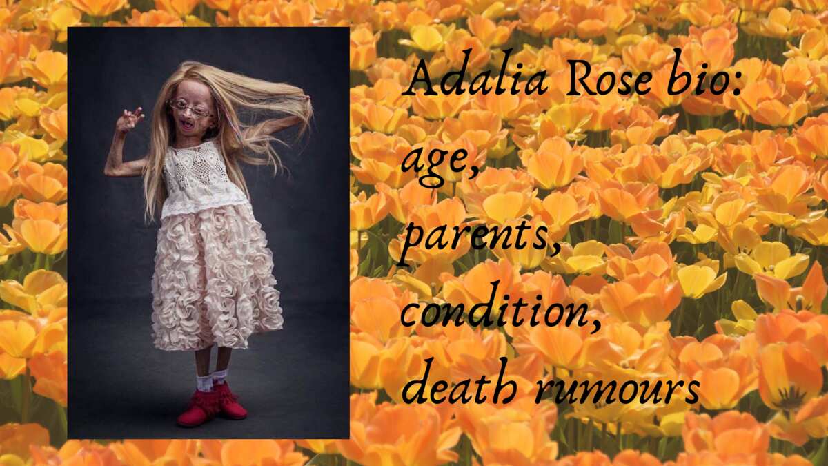 Fajarv Progeria Girl Adalia Rose