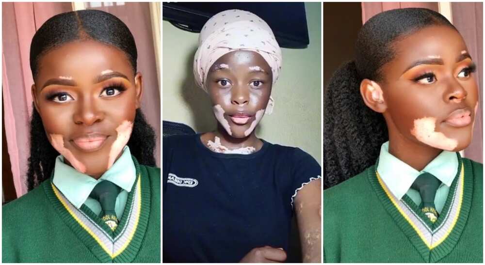 Photos of Kamogelo Ramaboya, a pretty black lady with vitiligo skin.