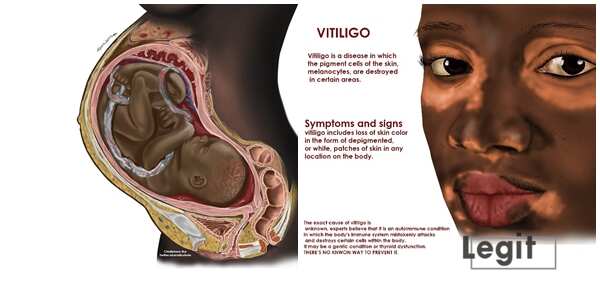 "I Wrote JAMB 5 Times," says Nigerian Student Behind Viral Black Medical Illustrations