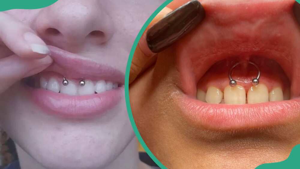 Two women with smiley piercing