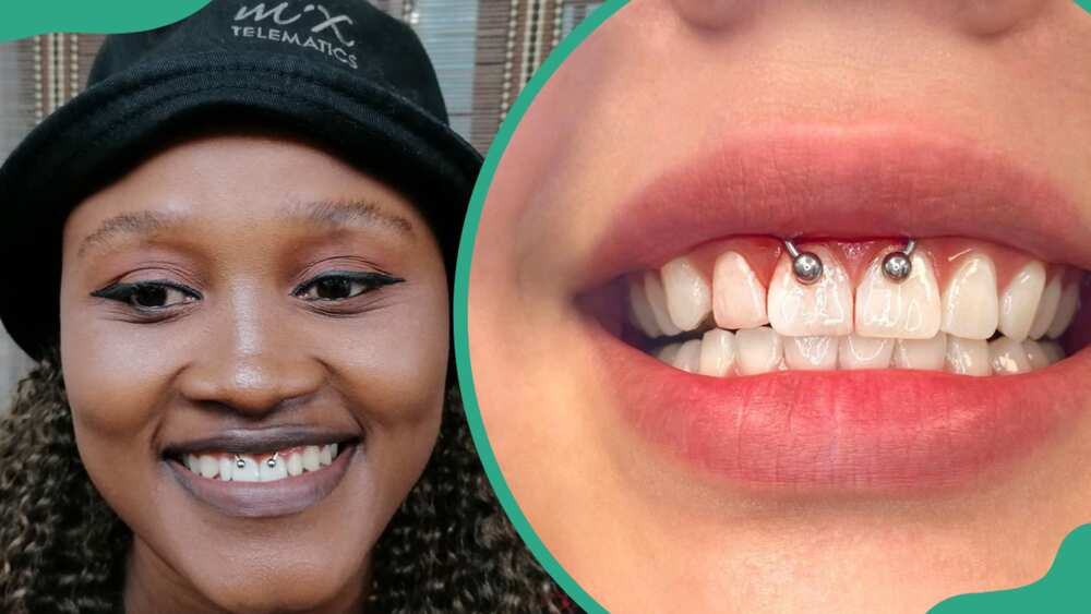 Two ladies showing the smiley piercing