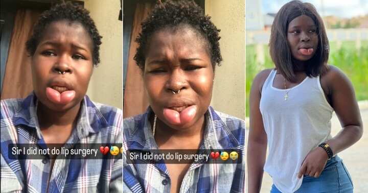 Watch sad video as lady with swollen lips opens up about reason behind condition