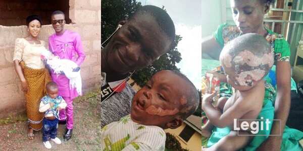Kenneth Ogagbo: Help 1-year-old boy who lost his mum to fire accident to beat burns